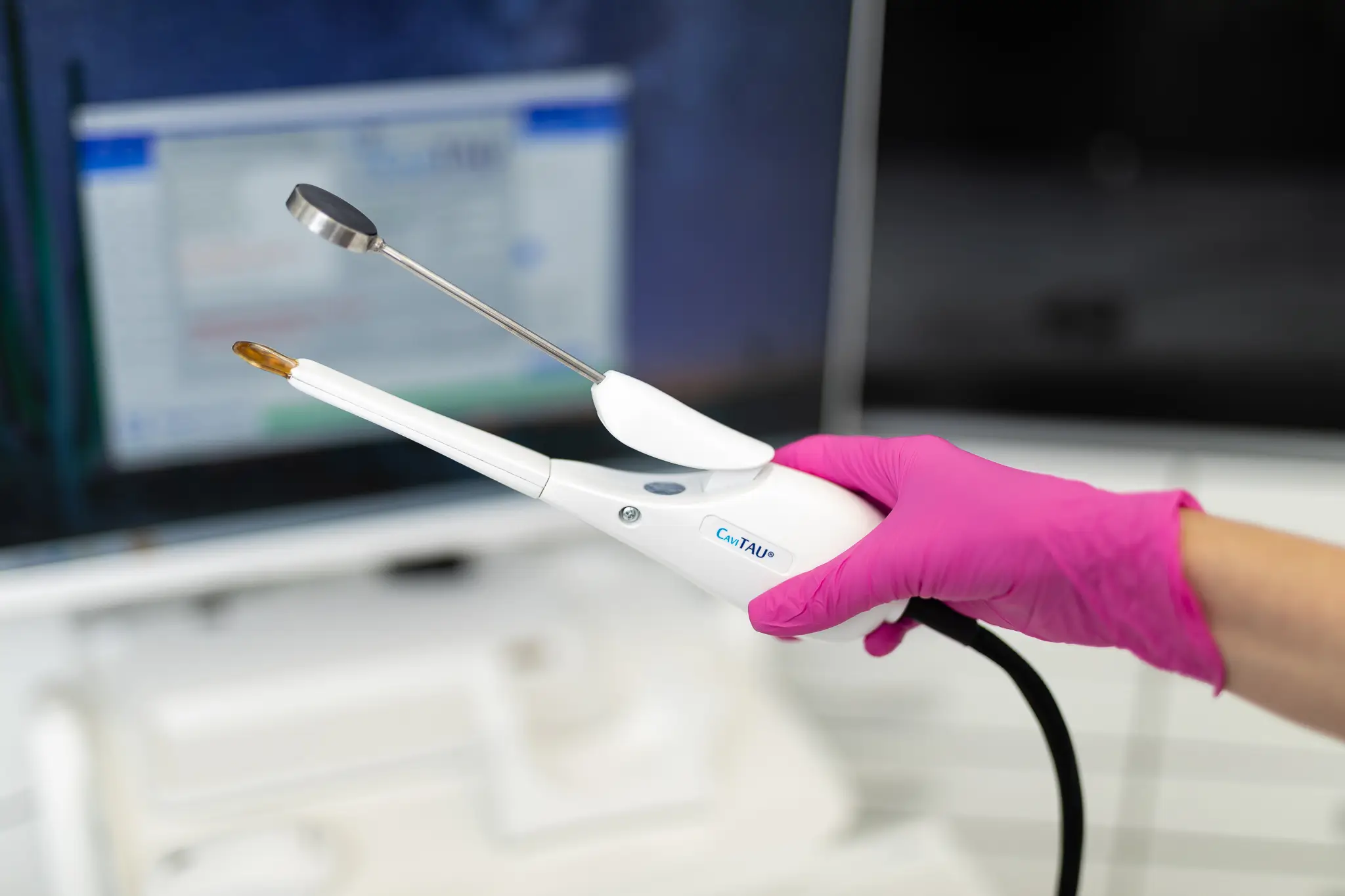CaviTAU Ultraschalldiagnostik für die Untersuchung von Kieferknochenveränderungen in Sopron